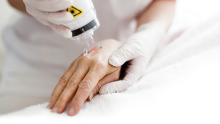 Skin Surgery